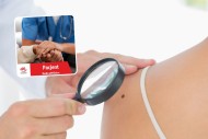 Ostrzegam przed lekceważeniem zmian skórnych