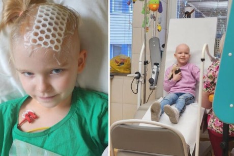 Czas ucieka… Pomóż Natalii pokonać guza mózgu