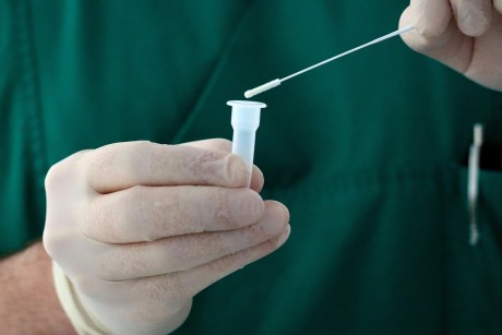 Narodowy Fundusz Zdrowia finansuje test na wykrycie wirusa HIV