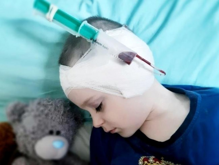 Czteroletni Miłoszek z Kielc stracił słuch. Wszczep implantu ślimakowego kosztuje prawie 150 tysięcy złotych